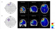 心理学部教授团队在《Brain Stimulation》杂志上发文揭示刺激前额叶区域对决策的影响及性别差异