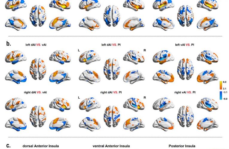 何清华教授团队在《Cerebral Cortex》上发文揭示了脑岛亚区的功能连接和调节机制